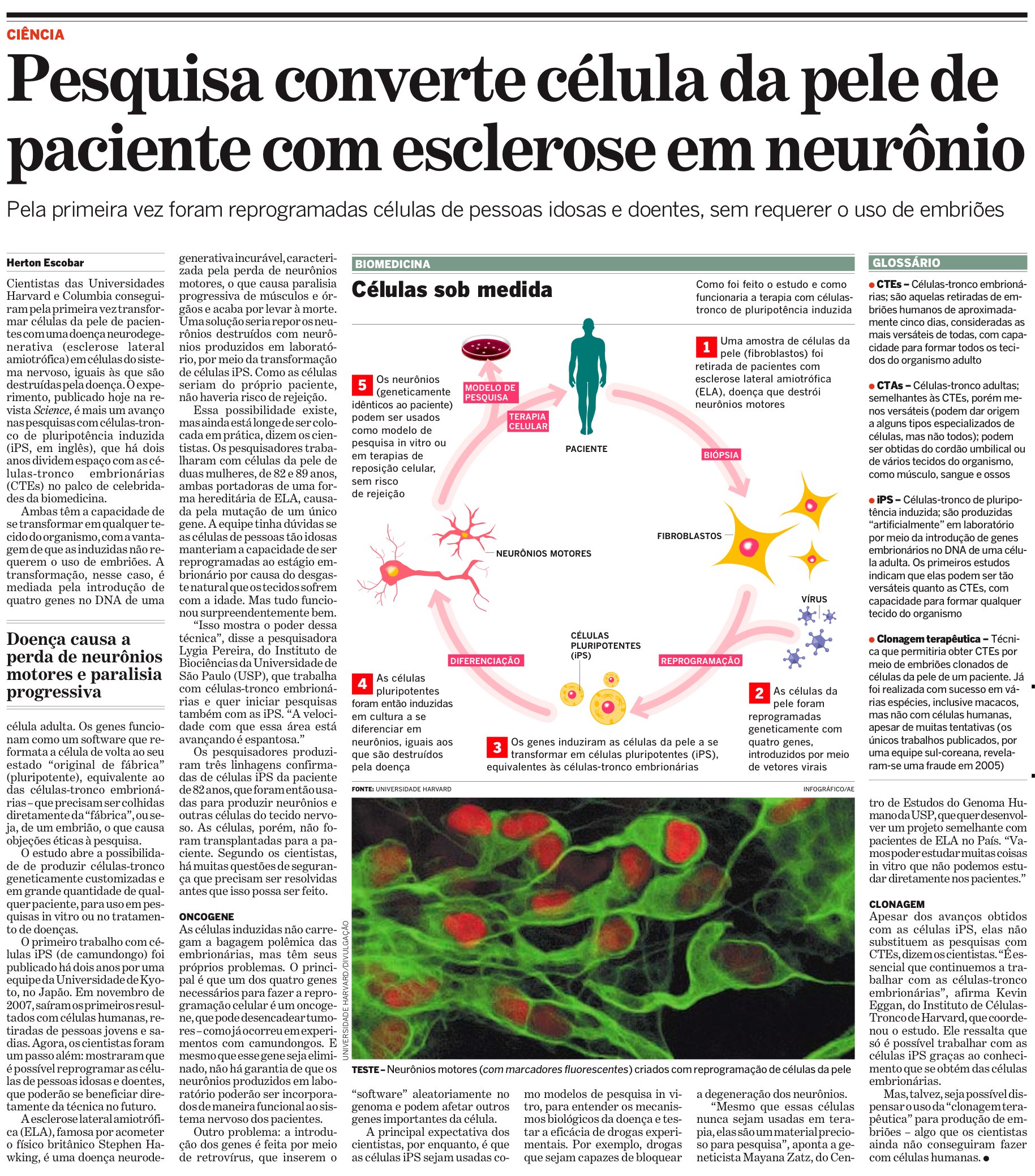 Célula da pele de paciente com esclerose vira neurônio